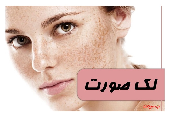ماسک‌های خانگی: راز بهبود لک صورت و درخشش پوست!